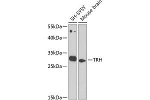 Western blot analysis of extracts of various cell lines, using TRH antibody (ABIN6130919, ABIN6149488, ABIN6149489 and ABIN6224343) at 1:1000 dilution. (TRH 抗体  (AA 25-230))