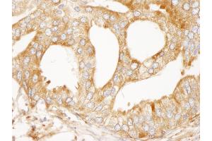 Immunohistochemistry (IHC) image for anti-Microtubule-Associated Protein 4 (MAP4) (AA 1102-1152) antibody (ABIN7448638)
