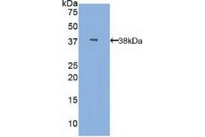 Detection of Recombinant MBL, Human using Polyclonal Antibody to Mannose Binding Lectin (MBL) (MBL2 抗体  (AA 42-96))