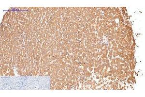 Immunohistochemistry of paraffin-embedded Human liver tissue using CD16 Monoclonal Antibody at dilution of 1:200. (CD16 抗体)