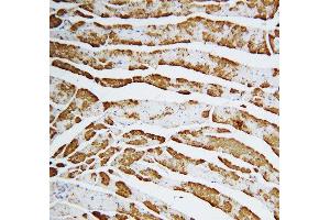 Anti-Cardiac FABP antibody, IHC(P) IHC(P): Rat Cardiac Muscle Tissue (FABP3 抗体  (C-Term))