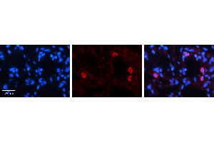 NFATC4 antibody - N-terminal region          Formalin Fixed Paraffin Embedded Tissue:  Human Lung Tissue    Observed Staining:  Cytoplasm of pneumocytes   Primary Antibody Concentration:  1:600    Secondary Antibody:  Donkey anti-Rabbit-Cy3    Secondary Antibody Concentration:  1:200    Magnification:  20X    Exposure Time:  0. (NFATC4 抗体  (N-Term))