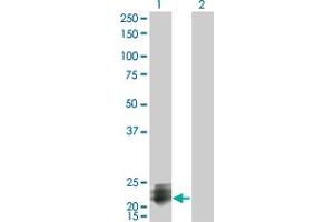 Western Blot analysis of STMN2 expression in transfected 293T cell line by STMN2 monoclonal antibody (M07), clone 2G7. (STMN2 抗体  (AA 73-179))