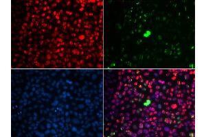 Immunofluorescence (IF) image for anti-Ataxia Telangiectasia Mutated (ATM) (pSer1981) antibody (ABIN3019429) (ATM 抗体  (pSer1981))