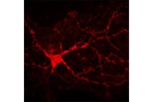 Indirect immunostaining of rat hippocampal neuron growing on astrocyte layer (dilution 1 : 200). (TNC 抗体)