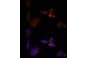 Immunofluorescence (IF) image for anti-Protein Kinase C, delta (PKCd) (AA 477-676) antibody (ABIN6146203)