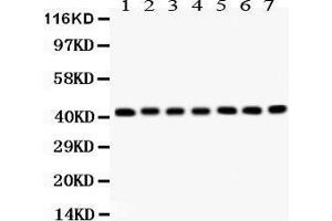 Anti- ACTIN antibody, Western blotting All lanes: Anti ACTIN  at 0. (Actin 抗体  (C-Term))