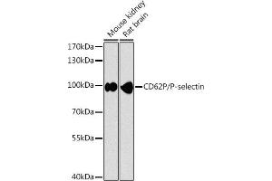 Western blot analysis of extracts of various cell lines, using CD62P/P-selectin antibody (ABIN6131513, ABIN6147502, ABIN6147505 and ABIN6216165) at 1:1000 dilution. (P-Selectin 抗体  (AA 220-319))
