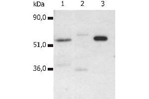 Immunoprecipitation of human CD4 from the lysate T cells isolated from fresh buffy coats. (CD4 抗体)