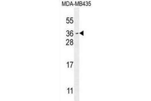 Western Blotting (WB) image for anti-Myc Target 1 (MYCT1) antibody (ABIN2995689) (Myc Target 1 抗体)