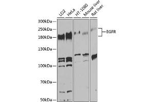 Western blot analysis of extracts of various cell lines, using EGFR antibody (ABIN6133679, ABIN6139975, ABIN6139980 and ABIN6215265) at 1:1000 dilution.