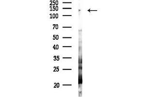 anti-WNK Lysine Deficient Protein Kinase 4 (WNK4) (pSer575) antibody