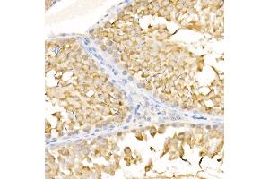 Immunohistochemistry of paraffin-embedded rat testis using KIF3A Rabbit pAb (ABIN6128170, ABIN6142871, ABIN6142872 and ABIN6222335) at dilution of 1:500 (40x lens). (KIF3A 抗体  (AA 430-699))
