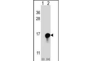 Western blot analysis of FKBP1A (arrow) using rabbit polyclonal FKBP1A Antibody (C-term) (ABIN1882082 and ABIN2841885). (FKBP1A 抗体  (C-Term))
