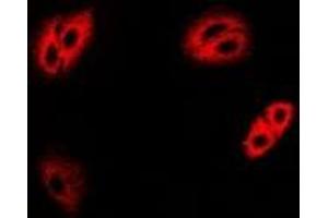 Immunofluorescent analysis of IRBP staining in MCF7 cells. (RBP3 抗体)