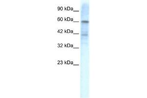 KCND3 antibody used at 1. (KCND3 抗体  (Middle Region))