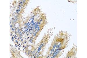 Immunohistochemistry of paraffin-embedded Human trachea using COX6B1 Polyclonal Antibody at dilution of 1:100 (40x lens). (COX6B1 抗体)