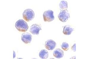 Immunocytochemistry of STAT1 alpha in HeLa cells with this product at 10 μg/ml. (STAT1 抗体  (C-Term))