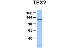 Host:  Rabbit  Target Name:  TEX2  Sample Type:  Human HepG2  Antibody Dilution:  1. (TEX2 抗体  (N-Term))