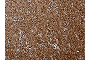 The image on the left is immunohistochemistry of paraffin-embedded Human brain tissue using ABIN7191804(PCDHAC1 Antibody) at dilution 1/50, on the right is treated with synthetic peptide. (PCDHAC1 抗体)