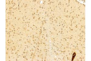 ABIN7094250 and ABIN7098297 at 1/100 staining Mouse brain tissue by IHC-P.
