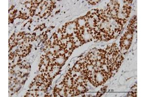 Image no. 1 for anti-Progesterone Receptor (PGR) (AA 1-111) antibody (ABIN598872) (Progesterone Receptor 抗体  (AA 1-111))