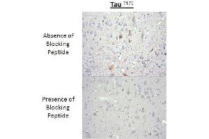 Immunohistochemistry analysis of a competition assay demonstrating the specificity of the anti-Tau (Thr-175) antibody (tau 抗体  (pThr175))