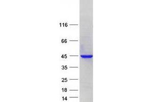 Western Blotting (WB) image for PRP18 Pre-mRNA Processing Factor 18 (PRPF18) protein (Myc-DYKDDDDK Tag) (ABIN2729828)