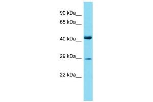 Host:  Rabbit  Target Name:  Prrx2  Sample Type:  Mouse Small Intestine lysates  Antibody Dilution:  1. (PRRX2 抗体  (Middle Region))