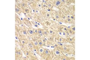 Immunohistochemistry of paraffin-embedded human liver injury using ACADS antibody. (ACADS 抗体)