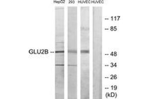 Western blot analysis of extracts from HepG2/293/HuvEC cells, using GLU2B Antibody. (PRKCSH 抗体  (AA 81-130))