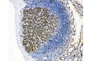 Immunohistochemistry (IHC) image for anti-Minichromosome Maintenance Complex Component 2 (MCM2) (AA 884-904) antibody (ABIN3031803)