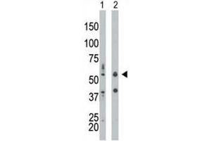 PKR antibody used in western blot to detect PRKR/PKR in mouse liver tissue lysate (Lane 1) and HepG2 cell lysate (2). (EIF2AK2 抗体  (AA 11-42))