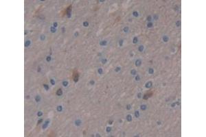 IHC-P analysis of Human Tissue, with DAB staining. (PPL 抗体  (AA 1439-1716))