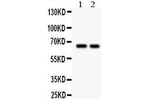 Lane 2: COLO320 Whole Cell Lysate at 40ug Predicted bind size: 65KD Observed bind size: 65KD (TGFBR2 抗体  (Middle Region))