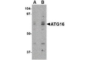Western Blotting (WB) image for anti-ATG16 Autophagy Related 16-Like 1 (ATG16L1) (Internal Region) antibody (ABIN2477528) (ATG16L1 抗体  (Internal Region))