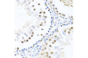 Immunohistochemistry of paraffin-embedded rat testis using DDX46 antibody  at dilution of 1:100 (40x lens). (DDX46 抗体  (AA 682-1031))