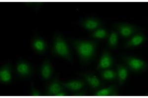 Immunofluorescence analysis of MCF7 cells using RORA Polyclonal Antibody (RORA 抗体)