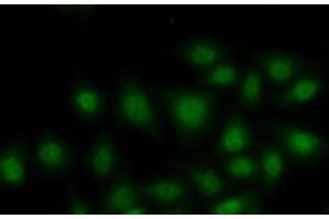 Immunofluorescence analysis of MCF7 cells using RORA Polyclonal Antibody