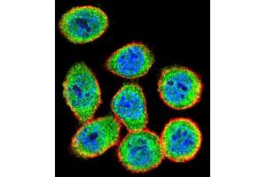 Confocal immunofluorescent analysis of IKK beta Antibody (ABIN1882097 and ABIN2842182) with Hela cell followed by Alexa Fluor 488-conjugated goat anti-rabbit lgG (green). (IKBKB 抗体)