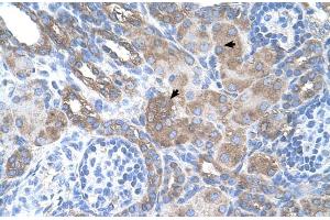 Human kidney (Melanoma gp100 抗体  (N-Term))