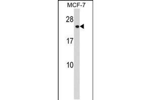 Western blot analysis in MCF-7 cell line lysates (35ug/lane). (CHMP1A 抗体  (N-Term))