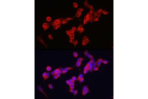 Immunofluorescence analysis of SH-SY5Y cells using KIF5A Rabbit pAb (ABIN1680589, ABIN3017664, ABIN3017665 and ABIN6220202) at dilution of 1:250 (40x lens). (KIF5A 抗体  (AA 933-1032))