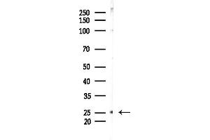 anti-Chemokine-Like Factor (CKLF) antibody