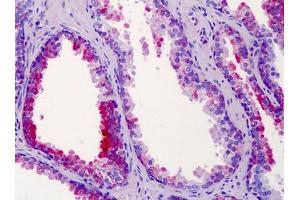Human Prostate: Formalin-Fixed, Paraffin-Embedded (FFPE) (ST14 抗体  (N-Term))