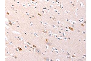 The image on the left is immunohistochemistry of paraffin-embedded Human brain tissue using ABIN7192139(RalA Antibody) at dilution 1/20, on the right is treated with synthetic peptide. (rala 抗体)