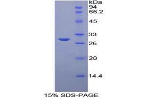 SDS-PAGE analysis of Rat B-Cell CLL/Lymphoma 3 Protein. (BCL3 蛋白)