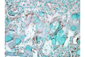 Immunohistochemistry analysis using Rabbit Anti-HSP70 Polyclonal Antibody . (HSP70 抗体  (APC))