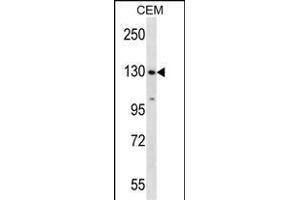SF3B1 Antibody (N-term) (ABIN657676 and ABIN2846668) western blot analysis in CEM cell line lysates (35 μg/lane). (SF3B1 抗体  (N-Term))