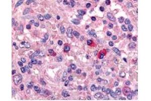 Affinity Purified anti-Artemis antibody was used at a 1:1000 dilution to detect Artemis by immunohistochemistry in human spleen. (DCLRE1C 抗体  (AA 482-495))